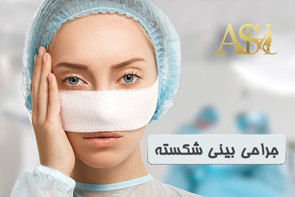 جراحی بینی شکسته - دکتر علی شفیعی