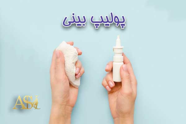 پولیپ بینی - دکتر علی شفیعی