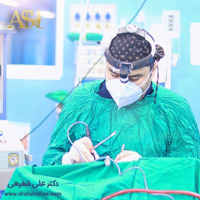 جراح بینی - دکتر علی شفیعی