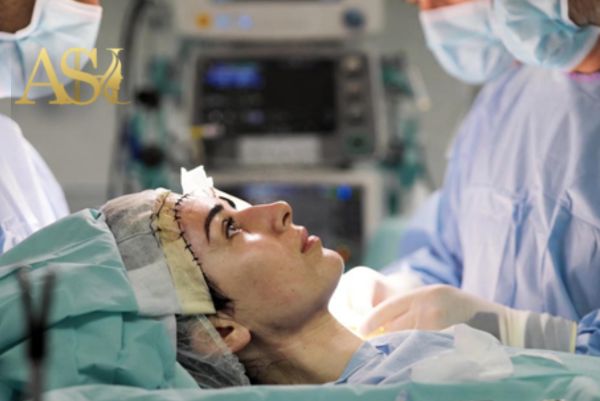 اجرای جراحی لیفت صورت