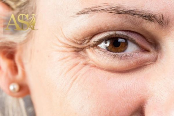 لیفت ابرو بهتر است یا بلفاروپلاستی؟