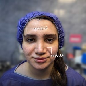 عمل ترکیبی تهران